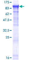 PANK4 Protein - 12.5% SDS-PAGE of human PANK4 stained with Coomassie Blue