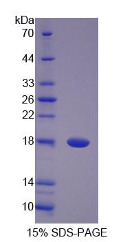 PANK4 Protein - Recombinant  Pantothenate Kinase 4 By SDS-PAGE