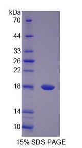 PANK4 Protein - Recombinant  Pantothenate Kinase 4 By SDS-PAGE