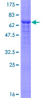 PANX1 / Pannexin 1 Protein - 12.5% SDS-PAGE of human PANX1 stained with Coomassie Blue