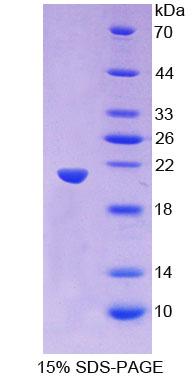 PANX1 / Pannexin 1 Protein - Recombinant  Pannexin 1 By SDS-PAGE