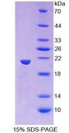 PANX1 / Pannexin 1 Protein - Recombinant  Pannexin 1 By SDS-PAGE