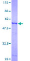 PAP2a / PPAP2A Protein - 12.5% SDS-PAGE of human PPAP2A stained with Coomassie Blue
