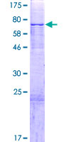 PAPD4 Protein - 12.5% SDS-PAGE of human PAPD4 stained with Coomassie Blue