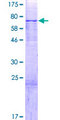 PAPD4 Protein - 12.5% SDS-PAGE of human PAPD4 stained with Coomassie Blue