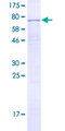 PAPD5 Protein - 12.5% SDS-PAGE of human PAPD5 stained with Coomassie Blue