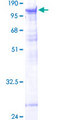 PAPOLB Protein - 12.5% SDS-PAGE of human PAPOLB stained with Coomassie Blue