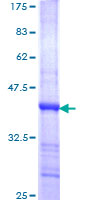 PAPPA / PAPP-A Protein - 12.5% SDS-PAGE Stained with Coomassie Blue.