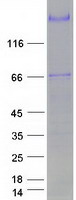 PAPPA / PAPP-A Protein - Purified recombinant protein PAPPA was analyzed by SDS-PAGE gel and Coomassie Blue Staining