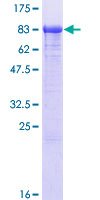 PAPSS 1 Protein - 12.5% SDS-PAGE of human PAPSS1 stained with Coomassie Blue
