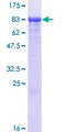 PAPSS 1 Protein - 12.5% SDS-PAGE of human PAPSS1 stained with Coomassie Blue