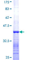 PAPSS 1 Protein - 12.5% SDS-PAGE Stained with Coomassie Blue.