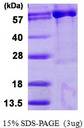 PAPSS 1 Protein