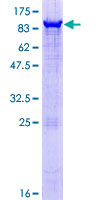 PAPSS2 Protein - 12.5% SDS-PAGE of human PAPSS2 stained with Coomassie Blue
