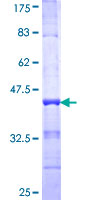 PAPSS2 Protein - 12.5% SDS-PAGE Stained with Coomassie Blue.