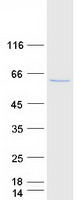 PAPSS2 Protein - Purified recombinant protein PAPSS2 was analyzed by SDS-PAGE gel and Coomassie Blue Staining