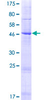 PAQR4 Protein - 12.5% SDS-PAGE of human PAQR4 stained with Coomassie Blue