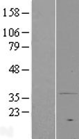 PAQR7 / mSR Protein - Western validation with an anti-DDK antibody * L: Control HEK293 lysate R: Over-expression lysate