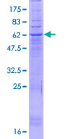 PAQR9 Protein - 12.5% SDS-PAGE of human PAQR9 stained with Coomassie Blue