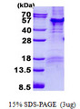 PAR6B / PARD6B Protein
