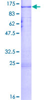 Paraplegin / SPG7 Protein - 12.5% SDS-PAGE of human SPG7 stained with Coomassie Blue