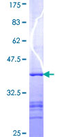 Paraplegin / SPG7 Protein - 12.5% SDS-PAGE Stained with Coomassie Blue.