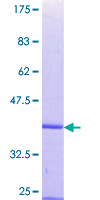 PARD3 Protein - 12.5% SDS-PAGE Stained with Coomassie Blue.