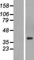 PARD6A / PAR6 Protein - Western validation with an anti-DDK antibody * L: Control HEK293 lysate R: Over-expression lysate
