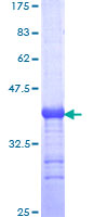 PARD6A / PAR6 Protein - 12.5% SDS-PAGE Stained with Coomassie Blue.