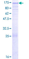 PARG Protein - 12.5% SDS-PAGE of human PARG stained with Coomassie Blue