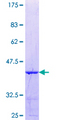 PARG Protein - 12.5% SDS-PAGE Stained with Coomassie Blue.