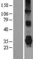 PARK2 / Parkin 2 Protein - Western validation with an anti-DDK antibody * L: Control HEK293 lysate R: Over-expression lysate