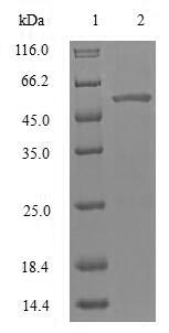 PARK2 / Parkin 2 Protein - (Tris-Glycine gel) Discontinuous SDS-PAGE (reduced) with 5% enrichment gel and 15% separation gel.