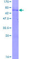 PARK2 / Parkin 2 Protein - 12.5% SDS-PAGE of human PARK2 stained with Coomassie Blue