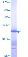 PARK7 / DJ-1 Protein - 12.5% SDS-PAGE Stained with Coomassie Blue.
