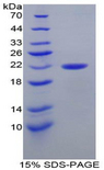 PARK7 / DJ-1 Protein - Recombinant Parkinson Disease Protein 7 By SDS-PAGE