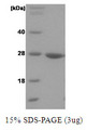 PARK7 / DJ-1 Protein