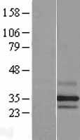 PARL / PSARL Protein - Western validation with an anti-DDK antibody * L: Control HEK293 lysate R: Over-expression lysate