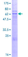 PARL / PSARL Protein - 12.5% SDS-PAGE of human PARL stained with Coomassie Blue