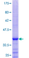 PARL / PSARL Protein - 12.5% SDS-PAGE Stained with Coomassie Blue.