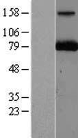 PARN Protein - Western validation with an anti-DDK antibody * L: Control HEK293 lysate R: Over-expression lysate