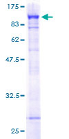 PARN Protein - 12.5% SDS-PAGE of human PARN stained with Coomassie Blue
