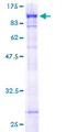 PARN Protein - 12.5% SDS-PAGE of human PARN stained with Coomassie Blue