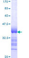 PARN Protein - 12.5% SDS-PAGE Stained with Coomassie Blue.