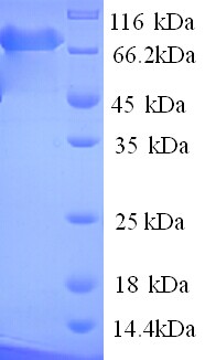 PARN Protein