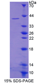 PARN Protein - Recombinant  Poly A Specific Ribonuclease By SDS-PAGE