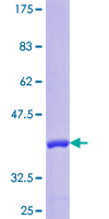 PARP1 Protein - 12.5% SDS-PAGE Stained with Coomassie Blue.