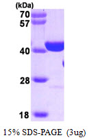 PARP1 Protein