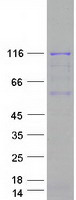 PARP1 Protein - Purified recombinant protein PARP1 was analyzed by SDS-PAGE gel and Coomassie Blue Staining