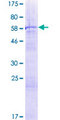PARP11 Protein - 12.5% SDS-PAGE of human PARP11 stained with Coomassie Blue